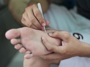 Bị gai đâm lút vào da thịt