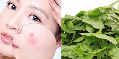 Rau mồng tơi giúp sạch da, giảm mụn