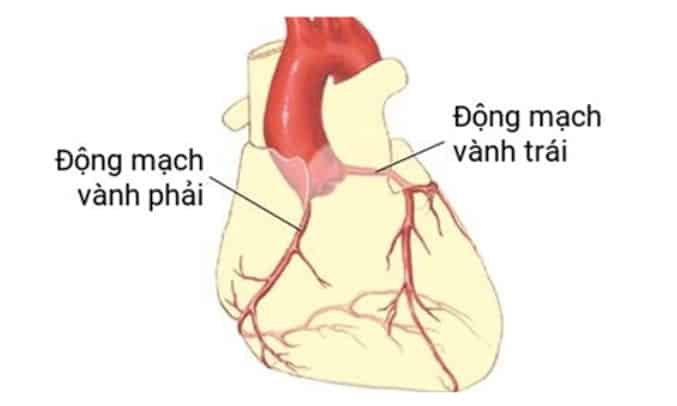 Tắc nghẽn động mạch vành