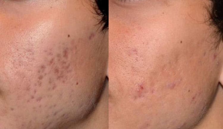 Ăn nước tương có bị thâm đen da không
